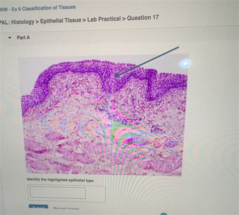 (Simple squamous is the <strong>tissue</strong> and the <strong>epithelial tissue</strong> is the <strong>tissue</strong> type. . Pal histology epithelial tissue lab practical question 1